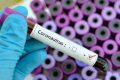 "Governo KO" Lo pneumologo: "il Coronavirus circolava in Italia già i primi di gennaio, gli studi lo confermano"