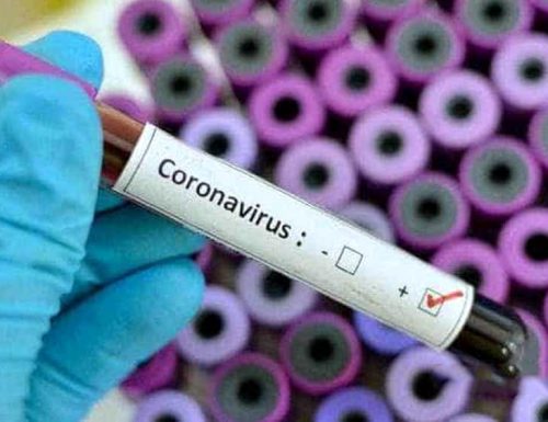 “Governo KO” Lo pneumologo: “il Coronavirus circolava in Italia già i primi di gennaio, gli studi lo confermano”