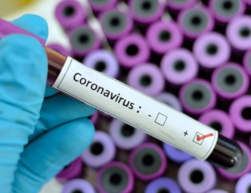 Coronavirus, i numeri salgono: il bollettino del 14 agosto registra 574 nuovi positivi e 3 decessi
