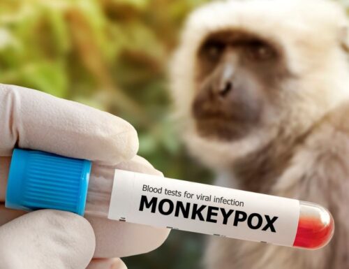 Lo Spallanzani apre al vaccino contro il Vaiolo delle scimmie. Ecco chi può farlo